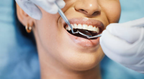Best Emergency Cosmetic Dentistry in University, MS