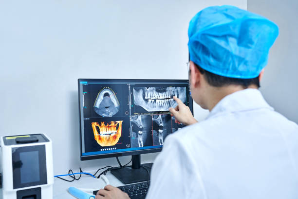 Best Emergency Dentist for Lost Fillings or Crowns in University, MS