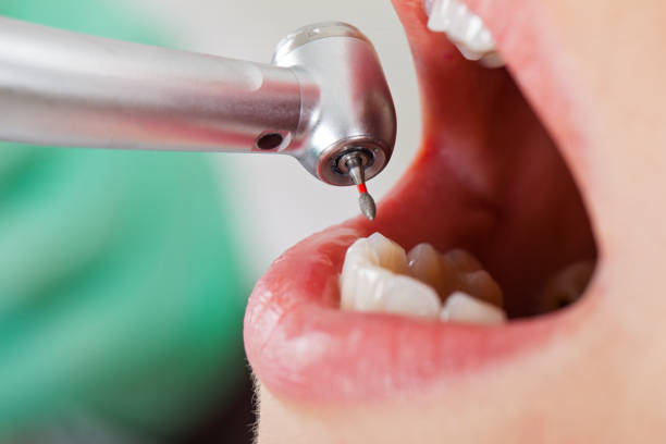 Best Orthodontic Emergency Dentist in University, MS